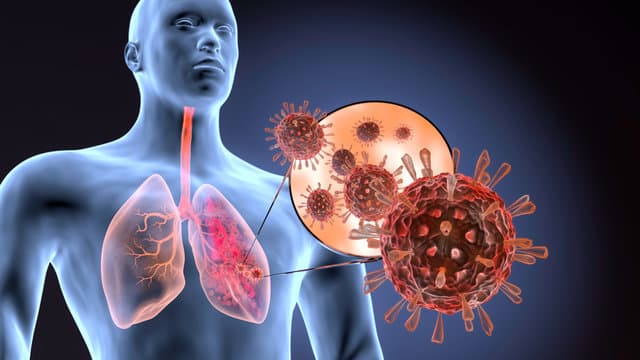 Lung Infection